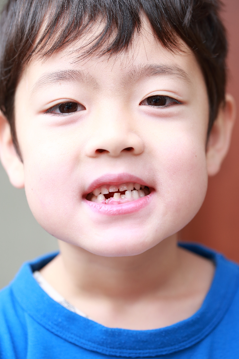 子どもの歯の変化